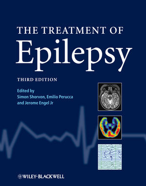 treatment of epilepsy simon shorvon