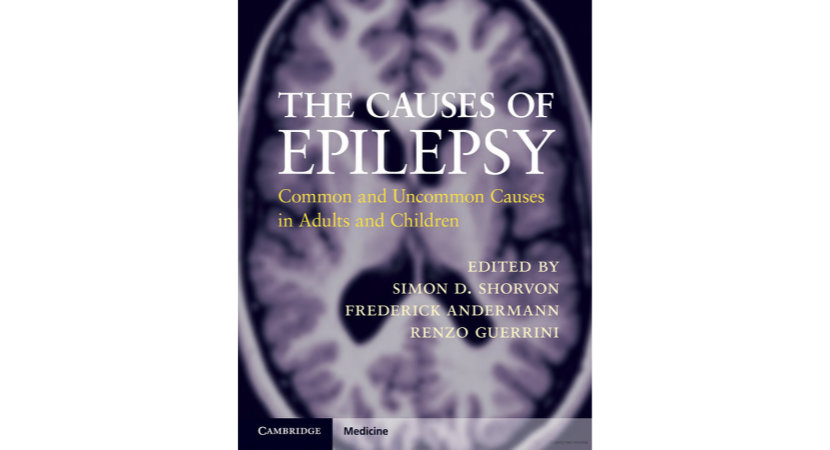 Causes of Epilepsy cover